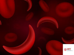 HFF Perto de Si | Sabe o que é Drepanocitose? E se lhe dissermos que pode ajudar?